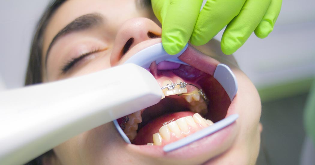 Periodoncia